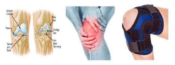 2 Knieverletzung kitesurfen-mallorca malliorca kiteschool April.